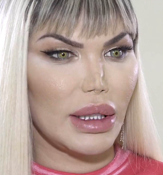 rodrigo alves ken umano cambia sesso donna operazione