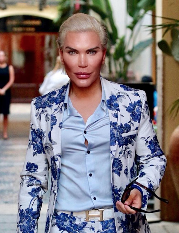 rodrigo alves ken umano cambia sesso donna operazione