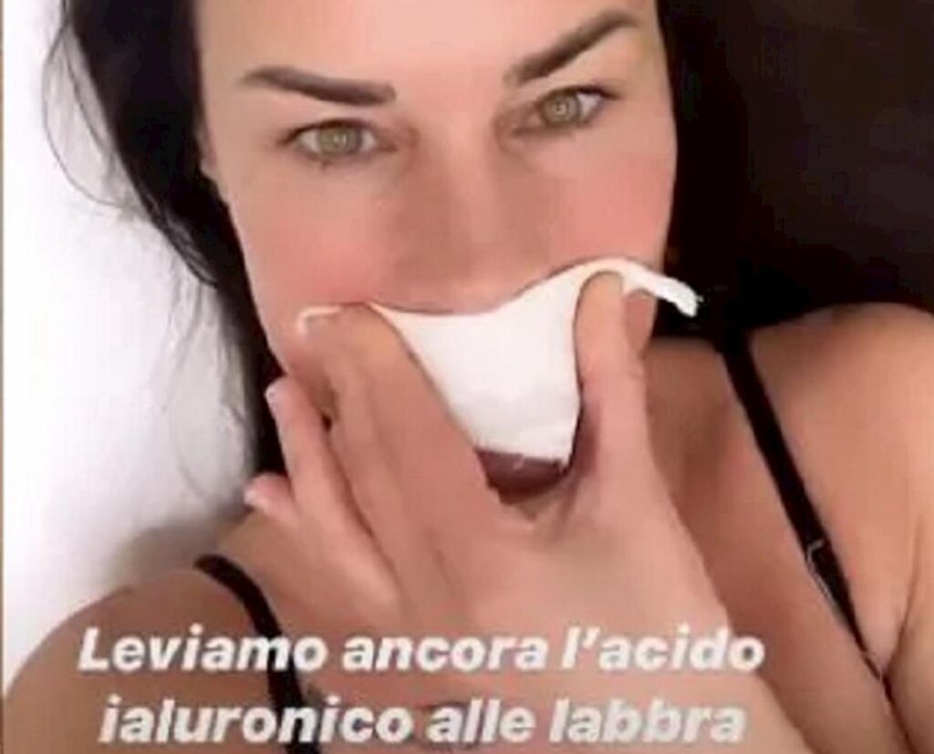 antonella mosetti labbra rifatte sgonfiate