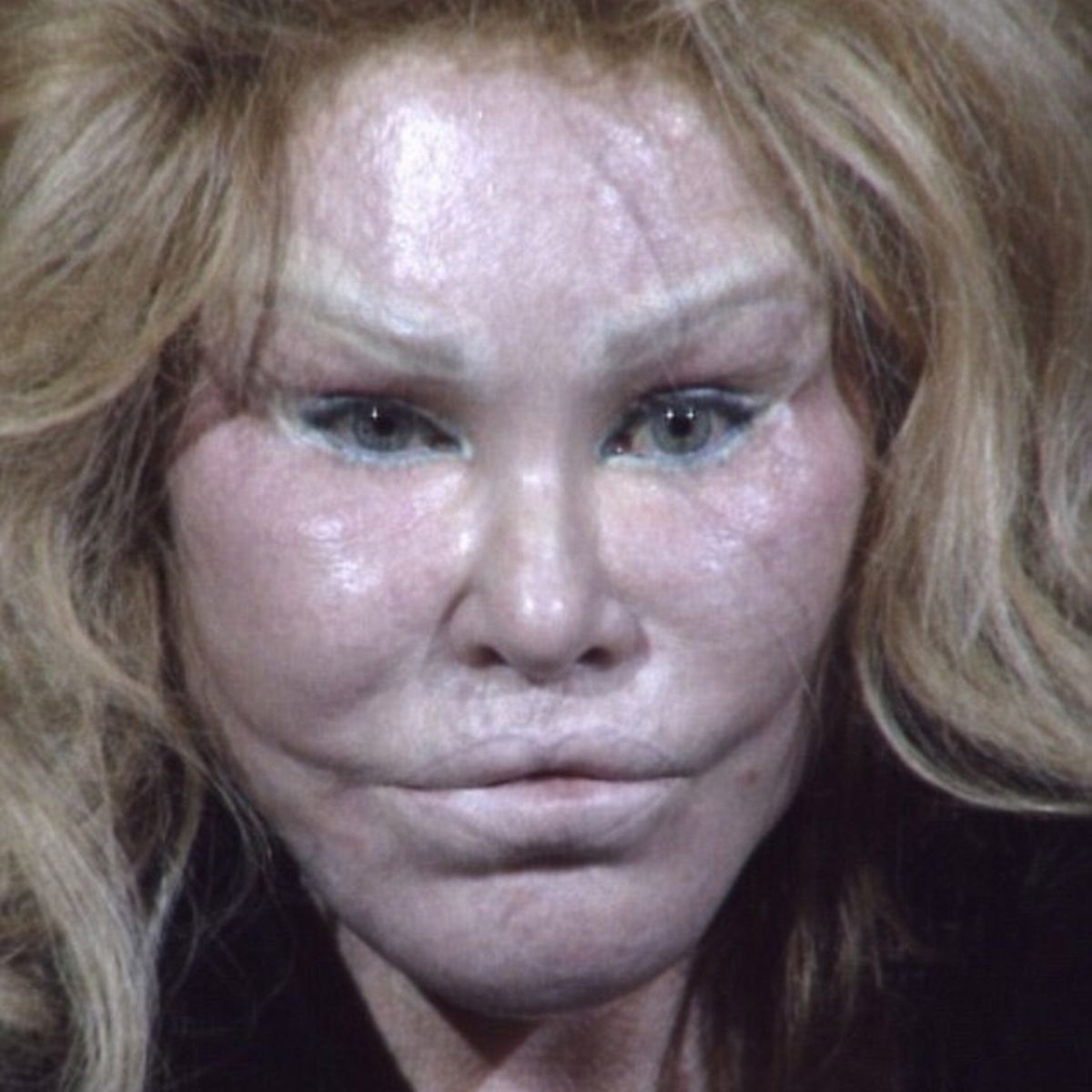 Jocelyn Wildenstein donna gatto chirugia ritocchi trasformata foto