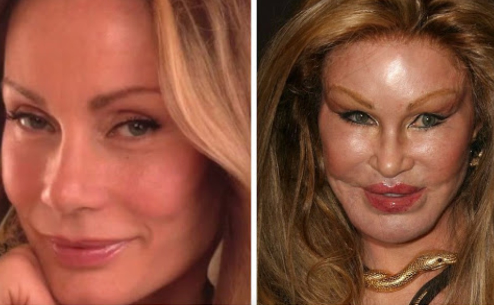 Jocelyn Wildenstein donna gatto chirugia ritocchi trasformata foto