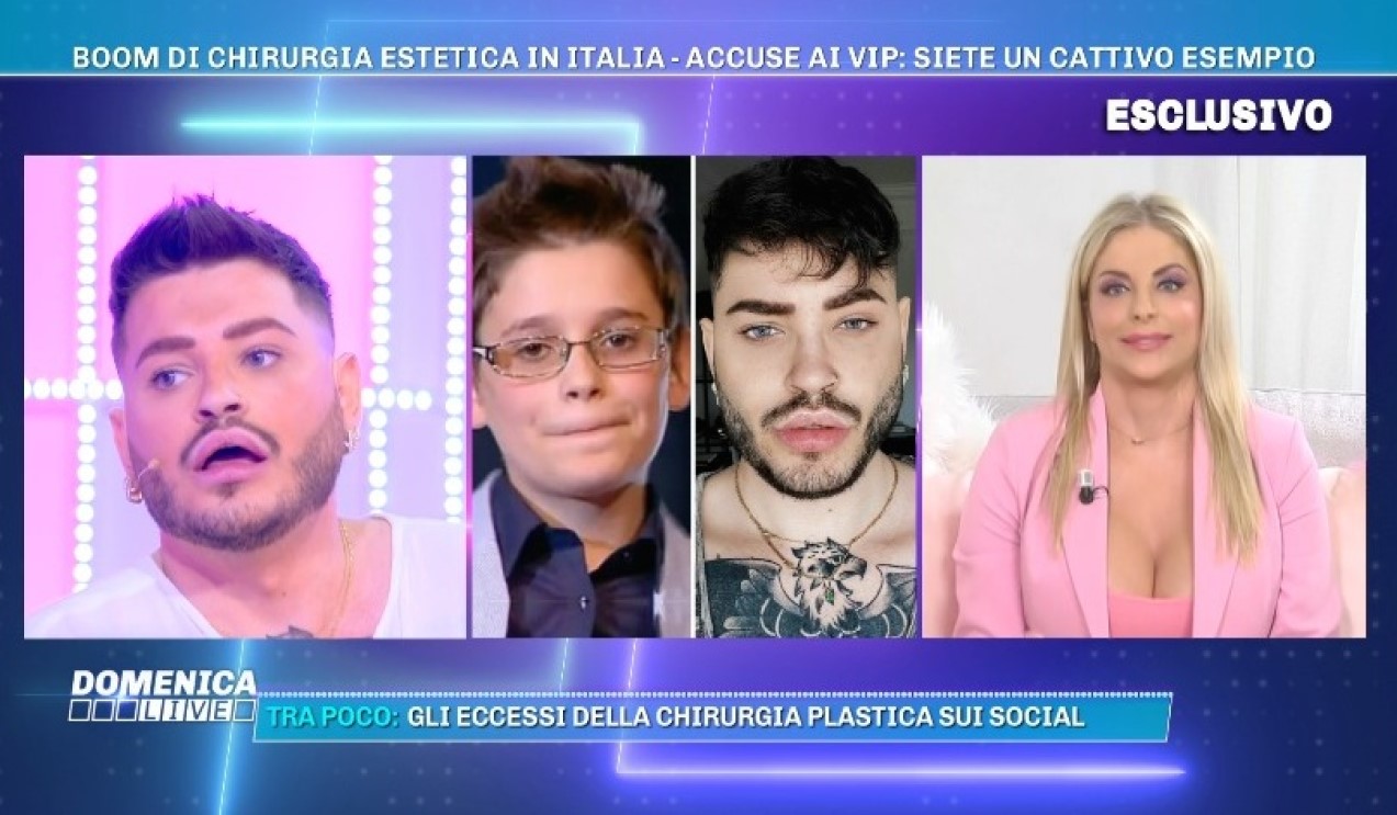 cristian imparato interventi ritocchi viso com'è diventato