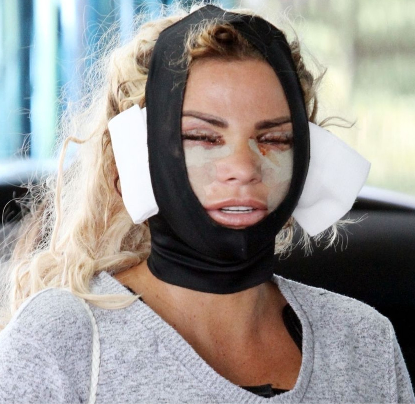 katie price interventi estetici rifatta foto