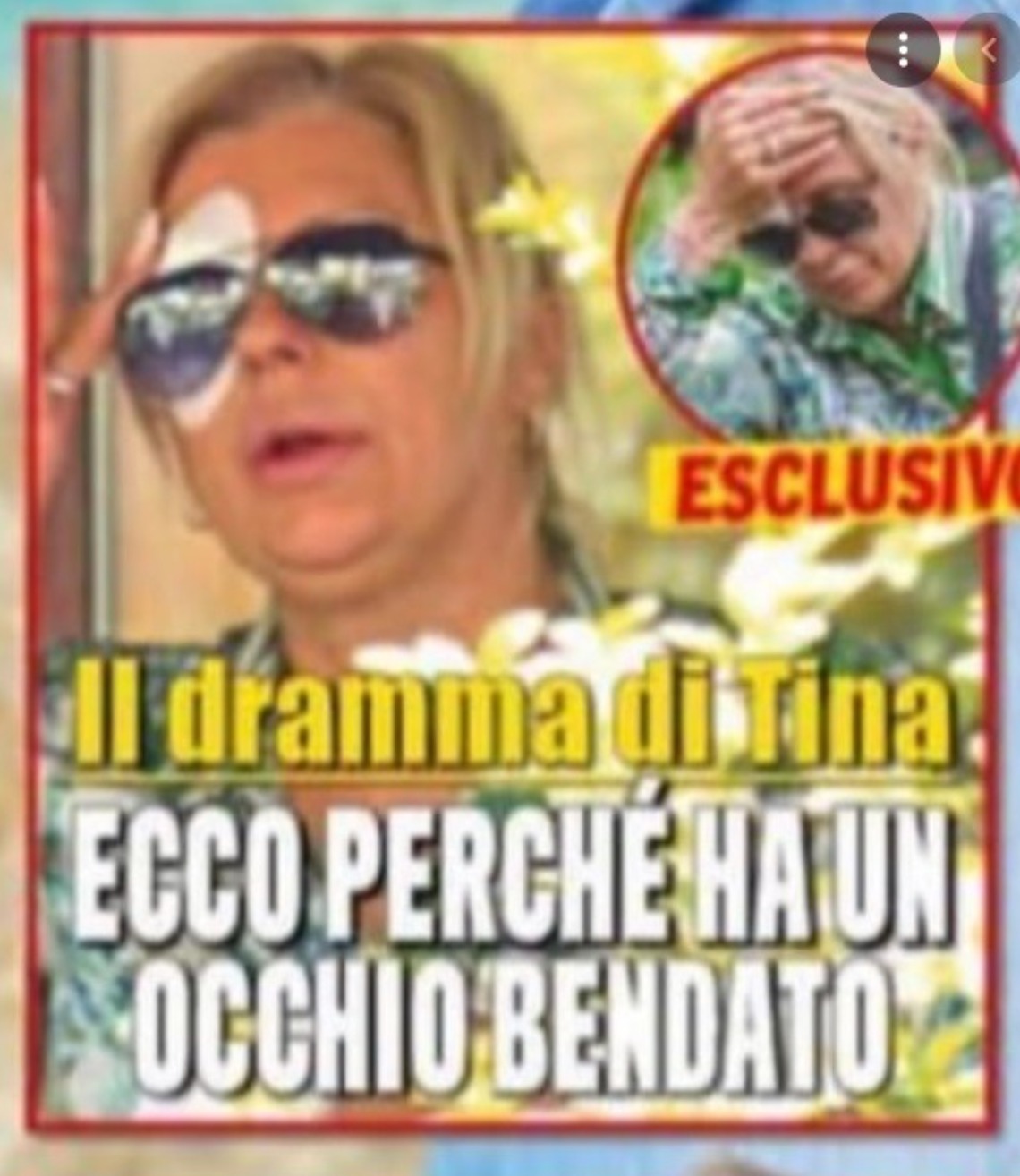 tina cipollari incidente occhio bendato