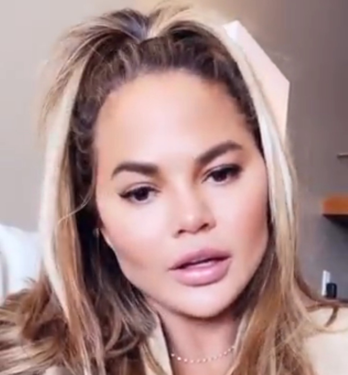 Chrissy Teigen ritocco intervento grasso viso