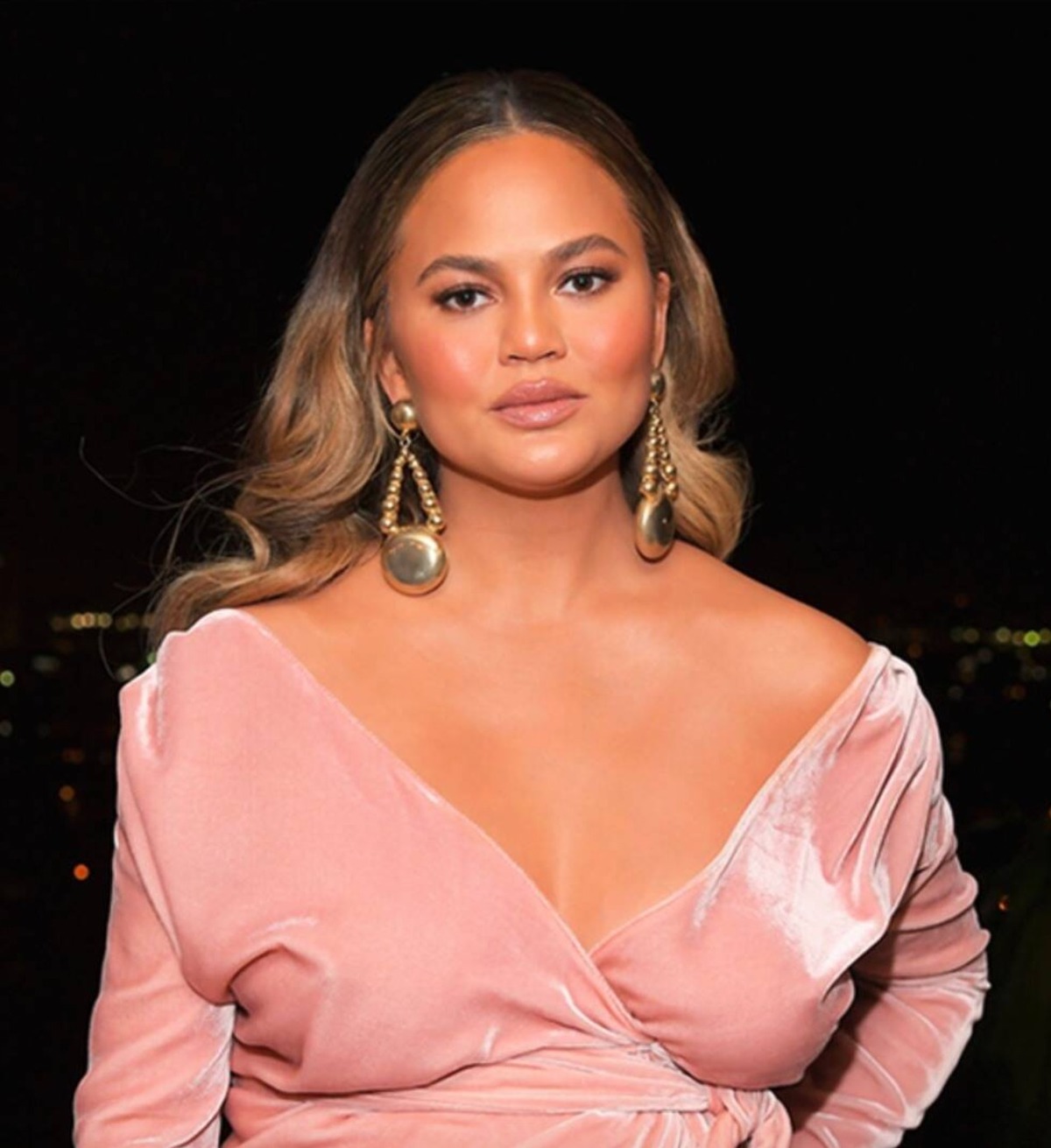 Chrissy Teigen ritocco intervento grasso viso