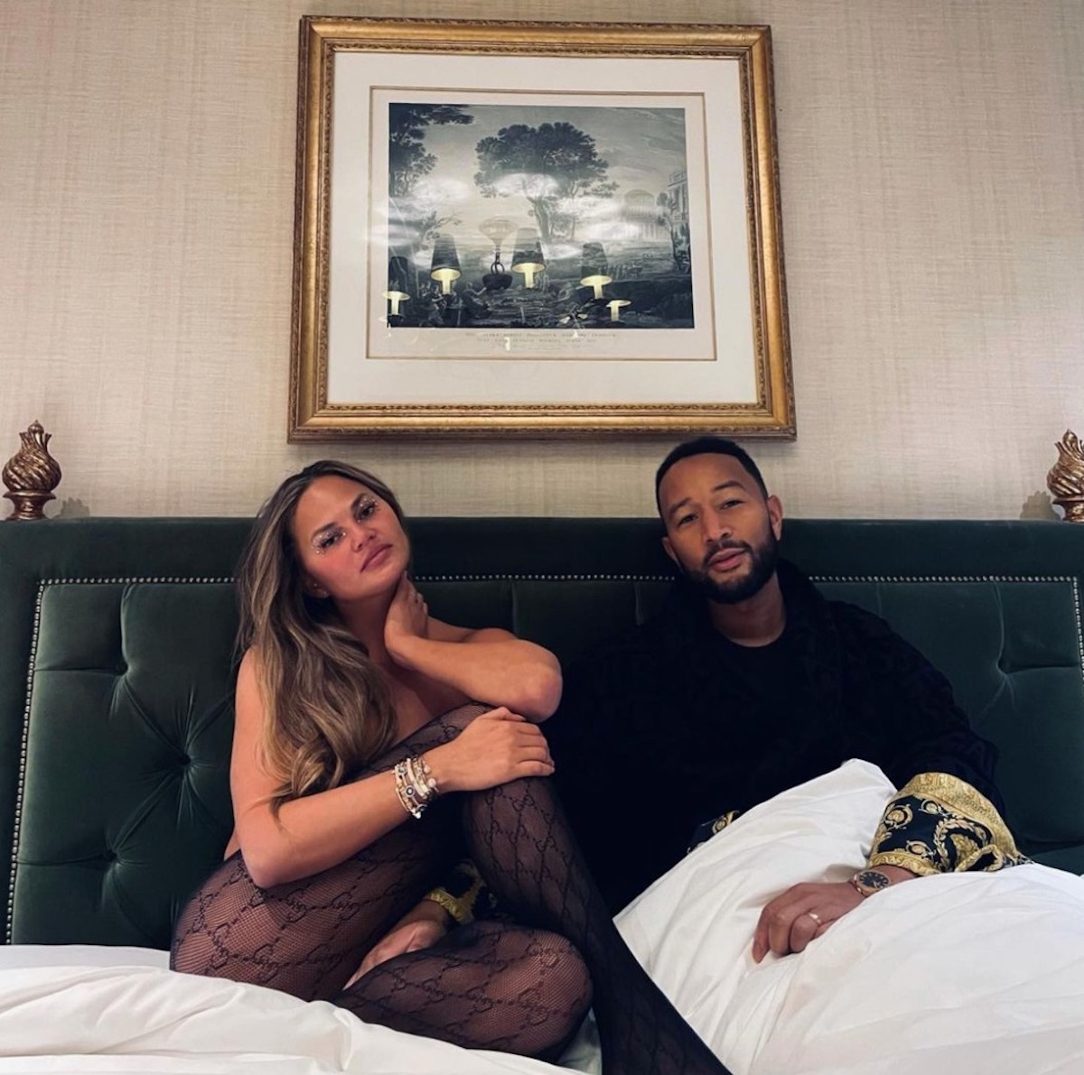 Chrissy Teigen ritocco intervento grasso viso